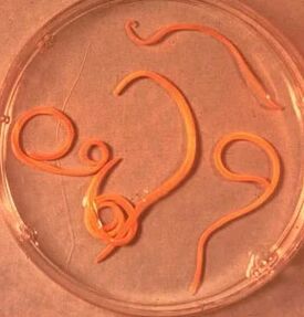 Parasiten vum Mann Ascarid