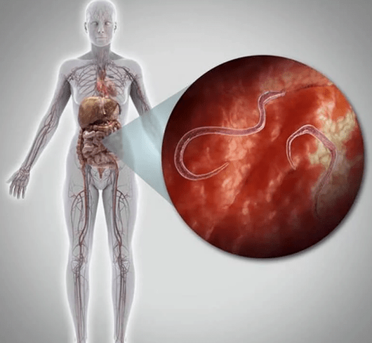 Parasiten am mënschleche Kierper