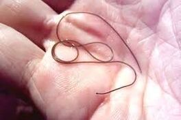 Parasit an der Handfläch