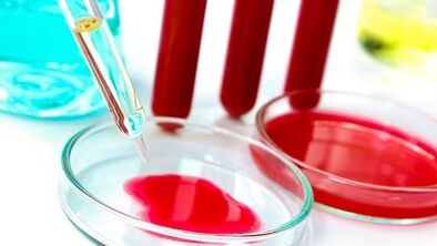 Bluttest fir Parasiten