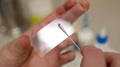 Calais Analyse fir Parasiten z'identifizéieren