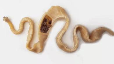 Wéi eng Präsenz vu Parasiten am Kierper entdecken