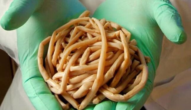 Entfernung vu Parasiten aus dem Kierper
