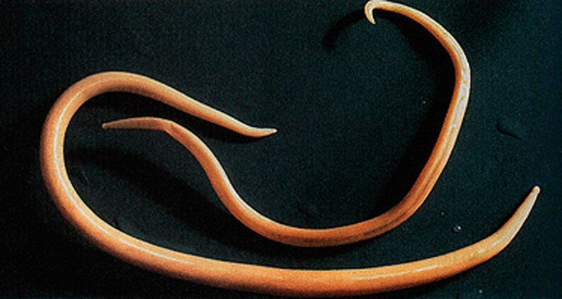 Wurmparasit aus dem mënschleche Kierper